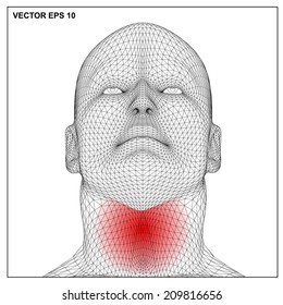 3d render Medical illustration showing inflamed, painful.