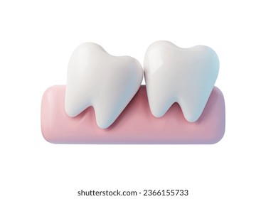 3D teeth grow incorrectly, tooth wrong tilted. Wisdom tooth eruption problems, inflamed gums. Vector realistic jaws dental anatomy illustration isolated on white. Orthodontic and dentistry 3d concept