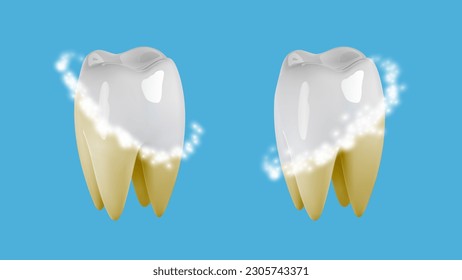 3d tooth whitening hygiene icon. Dental plaque cleaning with laser, toothpaste, for cavity protection, shiny bright smile, enamel care