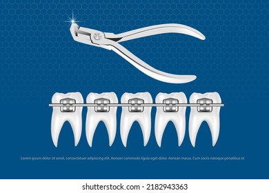 3d vector illustration, realistic teeth with braces upper and lower jaw. Alignment of the bite of teeth, dentition with braces, dental braces.