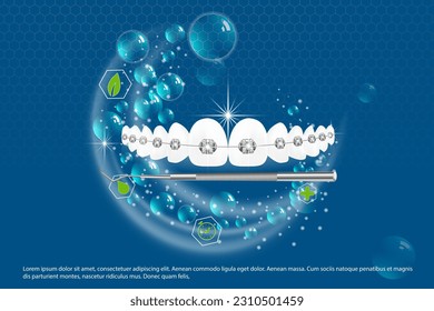 Ilustración vectorial 3d, dientes realistas con llaves. Alineación de la mordedura de los dientes, dentición con llaves, llaves dentales.