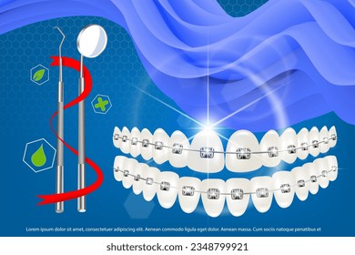 3d vector illustration, realistic teeth with braces upper and lower jaw. Alignment of the bite of teeth, dentition with braces, dental braces