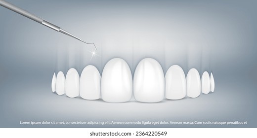 3d vector illustration, realistic teeth with braces upper and lower jaw. Alignment of the bite of teeth, dentition with braces, dental braces