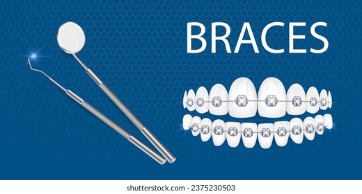 Ilustración vectorial 3d, dientes realistas con llaves. Alineación de la mordedura de los dientes, dentición con llaves, llaves dentales.