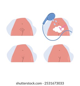 4 steps of shaving routine. Real female body with stretch marks. Set of woman shaves her pubic hair with a razor. Flat vector illustration in cartoon style. 