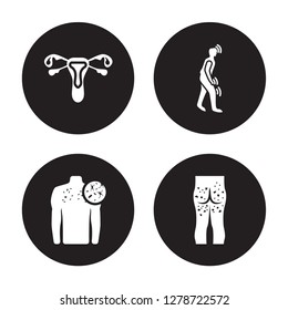 4 vector icon set : Non-gonococcal urethritis, Neoplasm, Night blindness, Necrotizing Fasciitis isolated on black background