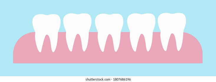 5 healthy teeth on the gums vector llustration. The result of teeth whitening