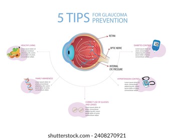 5 consejos para la prevención del glaucoma. Diagrama de un ojo con glaucoma sobre fondo blanco y rodeado por 5 puntas para la prevención.