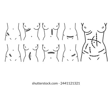 Abdominal incisions line icons set. Vector isolated element. Editable stroke.