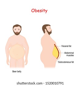 Abdominal obesity. Visceral and subcutaneous fat. Silhouette of a man with highlighted locations of Abdominal fat. Vector illustration