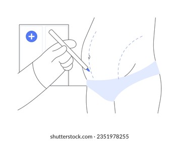 Ilustración del vector conceptual abstracto de la abdominoplastia. Cirujano plástico que produce tumores de paciente en la sala de operaciones, el sector de la medicina, el procedimiento de abdominoplastia, la metáfora abstracta de corrección corporal.