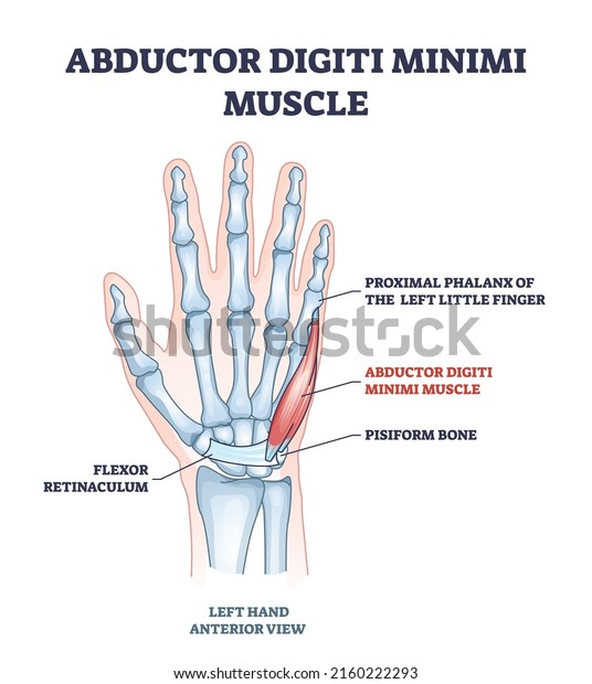 Abductor digiti minimi muscle with hand and\
palm skeleton outline diagram. Labeled educational scheme with xray\
flexor retinaculum, proximal phalanx of little finger and pisiform\
vector illustration.