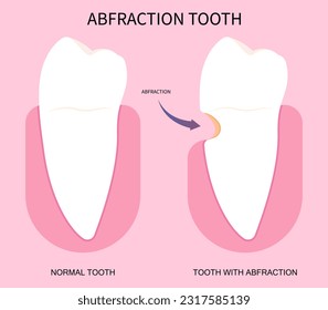 Vista lateral de la caries dental que causa dolor y dolor en el concepto odontológico