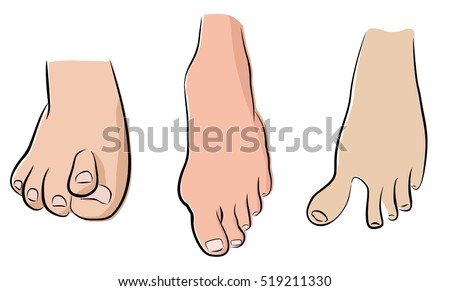 abnormal feet