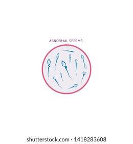 Abnormal spermatozoids morphology shape and form flat vector illustration isolated on white background. Male fertility and human semen icon for health care design.