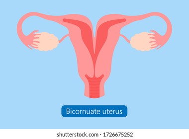 Abnormal Uterus Tipped Septum Missed Mature Cervix Double Absent Defect System Period Loss Cycle Birth Labor Short Uterus Female Treat Risk Type Exam Woman Ducts Shape