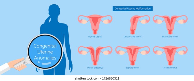 Abnormal Uterus Tipped Septum Missed Mature Cervix Double Absent Defect System Period Loss Cycle Birth Labor Short Uterus Female Treat Risk Type Exam Woman Ducts Shape