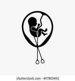 Abortion Is Personal Decision. Embryo with scissors. Flat vector illustration. Abortion sign, Abortion illustration, Abortion icon, Abortion isolated, Abortion image, Abortion vector