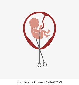 Abortion Is Personal Decision. Embryo with scissors. Flat vector illustration. Abortion sign, Abortion illustration, Abortion icon, Abortion isolated, Abortion image, Abortion vector