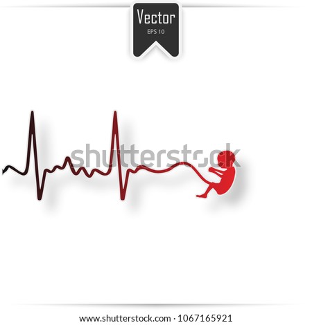 Abortion Is Personal Decision. Embryo with scissors. Flat vector illustration. Abortion sign, Abortion illustration, Abortion icon