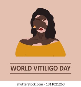 Abstract african woman silhouette with vitiligo. Vector concept to support people living with vitiligo and to build awareness about chronic skin disorder. Self care and self love. Skin problem.