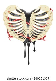 Abstract cartoon bleeding black heart in a rib cage.