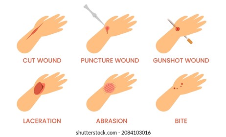 Abstract Flat Doctor Help Types Of Injuries Cut, Puncture, Gunshot, Bite, Laceration First Aid Cartoon People Character Concept Illustration Vector Design Style