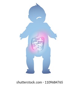 Abstract Illustration Of An Ill Baby Intestine. Sick Digestion Of A Child.