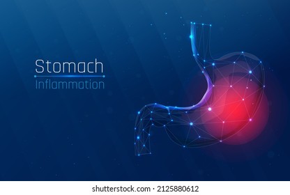 Abstrakte Linie und Punkt. Entzündung des menschlichen Magens. dringende medizinische Versorgung. Low-Poly-Gesundheitswesen, Vektorgrafik. Plexus, Wireframe-Stil. das Medikament
