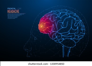 Abstract Polygonal Light Of Human Brain Inflammation. Business Wireframe Mesh Spheres From Flying Debris. Headache Concept. Blue Structure Style Vector Illustration With Geometry Triangles.