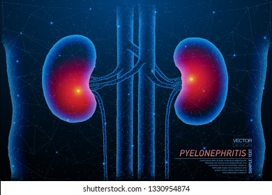 Abstract polygonal light of kidneys inflammation structure. Business wireframe mesh spheres from flying debris. Pyelonephritis concept. Blue structure style vector illustration.