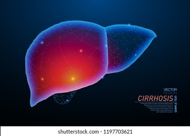 Abstract polygonal light of liver inflammation structure. Business wireframe mesh spheres from flying debris. Cirrhosis concept. Blue structure style vector illustration with geometry triangles.