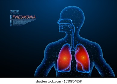 Abstraktes polygonales Licht der Lungenentzündungsstruktur. Business Wireframe Maschendraht Kugeln aus fliegenden Trümmern. Pneumonie-Konzept. Vektorillustration im blauen Strukturstil mit geometrischen Dreiecken.