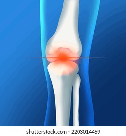 Resumen de ciencia médica de rodilla El concepto de hospital e investigación en forma de papeleo.