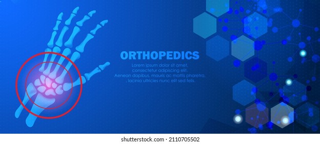 Abstract science medical orthopedics of wrist  and hand injury. The concept for hospital and research.