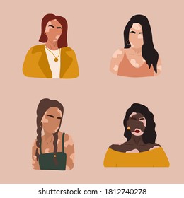 Abstract women silhouettes with vitiligo of different nationalities. Vector concept to support people living with vitiligo and to build awareness about chronic skin disorder. Self care and self love.