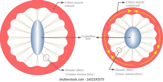 Ciliary Muscle Contracted Images, Stock Photos & Vectors | Shutterstock