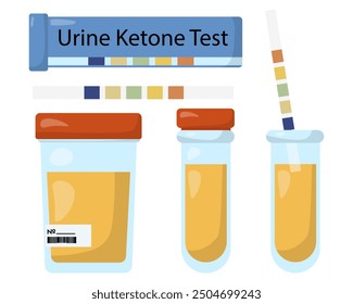 acetone test strips and test tubes with urine, urine ketone test vector illustration
