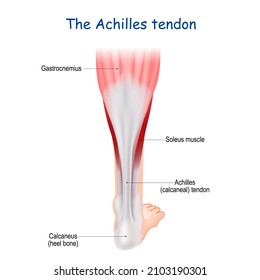 The Achilles tendon serves to attach the plantaris, gastrocnemius (calf) and soleus muscles to the calcaneus (heel) bone. heel cord or calcaneal tendon. Human leg. Medical infographic