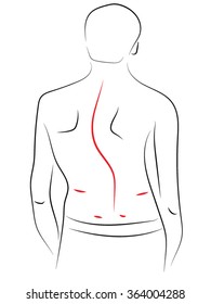 Aching backbone, man with a naked torso, standing back, iskrevlenie spine. Vector illustration on the theme of poor posture.