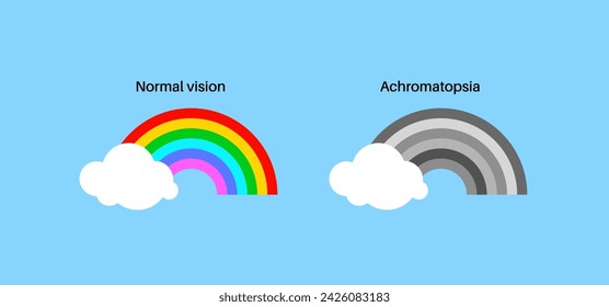 Achromatopsia and normal vision, color blindness infographic. Human vision deficiency concept. Difference between colors, brightness and intensity of shades. Eye abnormality flat vector illustration