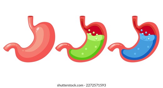 acid reflux concept Gastroesophageal Human stomach full of gastric acid, vector illustration