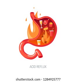 Acid reflux disease concept. Human stomach on fire, cut view. Vector illustration in flat style.