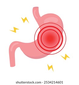 Reflujo ácido. dolor pancreático. dolor de estómago. enfermedad del problema gastrointestinal 