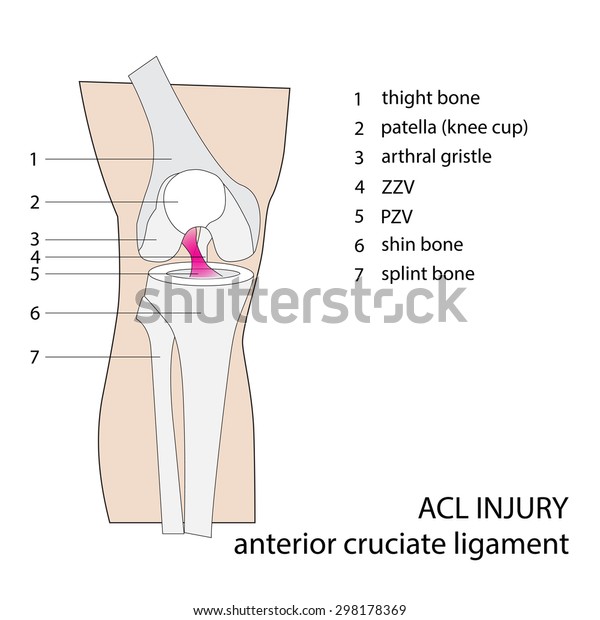 Acl Anterior Cruciate Ligament Vector Format 库存矢量图 免版税