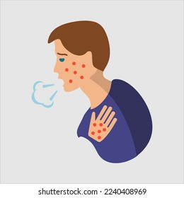 Alergias acnales inflamación vectorial daño cicatrización diseño de la enfermedad
