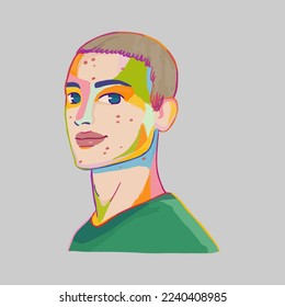 Acne allergies vector inflammation damage scar disease design