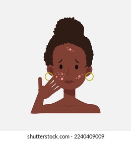 Acne allergies vector inflammation damage scar disease design