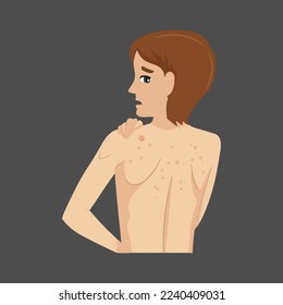 Alergias acnales inflamación vectorial daño cicatrización diseño de la enfermedad