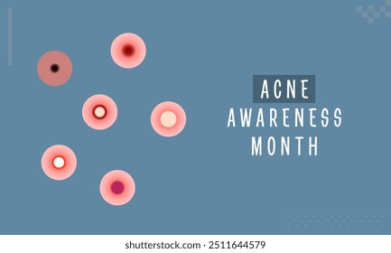 Acne Awareness Month. Acne and Skin Problem. Body skin acne type blackheads, whiteheads, papule, pustule, cyst and nodules. Acne types, skin pimples blackheads and face comedones